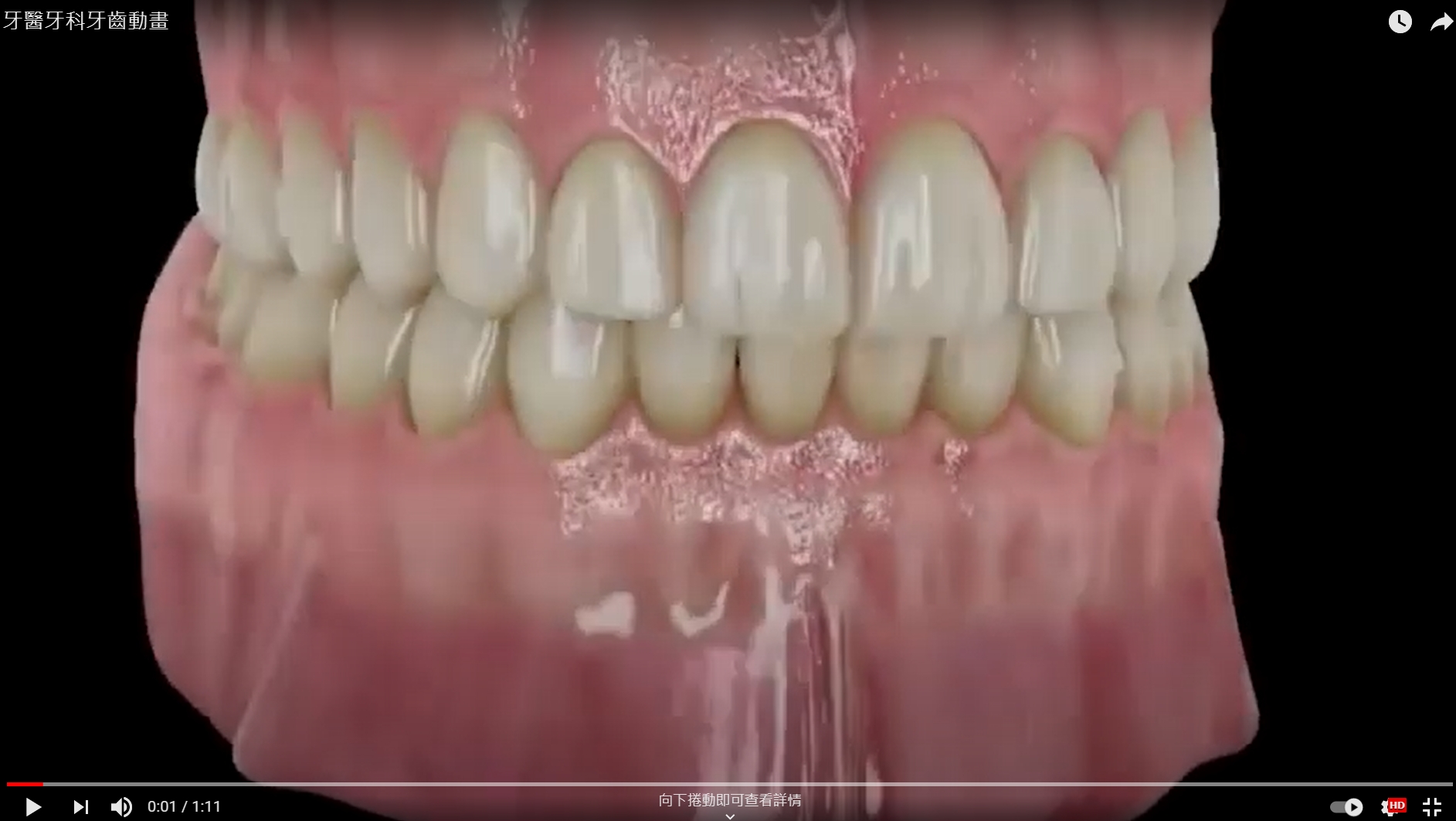 牙醫牙科牙齒動畫